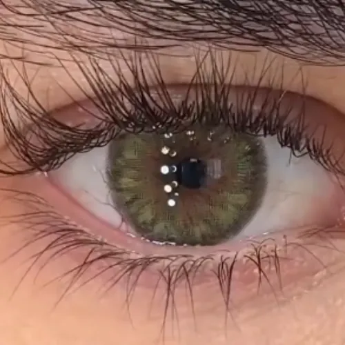 Lentes de contacto